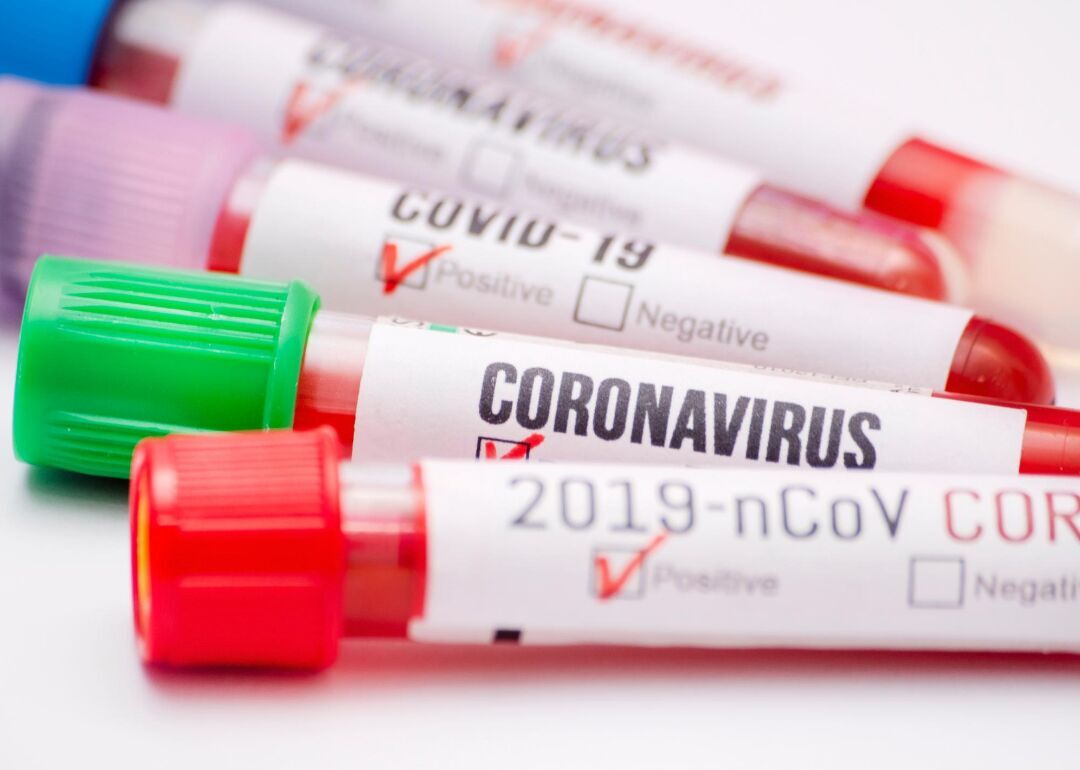 Children are less likely to be tested for COVID-19
